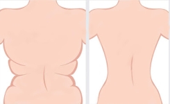 Il suffit juste ces 2 ingrédients et vous allez pouvoir perdre 5kg