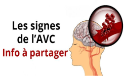 AVC : Vous devez connaître ces 4 astuces pour sauver des vies : chaque seconde compte