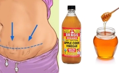 Miel + Vinaigre de Cidre : Le Meilleur Remède Contre la Constipation