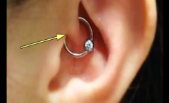 L’Acupuncture Auriculaire : Une Méthode Naturelle aux Multiples Bienfaits