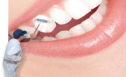  Méthodes pour blanchir les dents