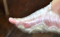  Détoxifiez Votre Corps avec des Pansements d’Oignons: Un Remède Naturel de Nos Ancêtres