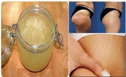 Crème Anti-Cellulite faite maison