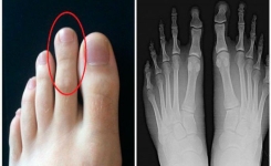 Quel est l’orteil le plus long de votre pied ? Une caractéristique qui en dit long sur votre personnalité