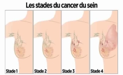 Voici ce que fait l’huile d’olive au cancer, alzheimer et d’autres maladies