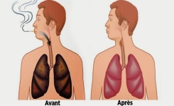 Ces aliments nettoient vos poumons de la nicotine et des goudrons