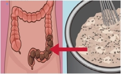 Comment Faire Pour Nettoyer Votre Côlon Et Perdre 20 Kilos En 3 Semaines !