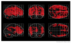 Une graine exceptionnelle pour ralentir le vieillissement du cerveau