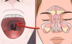 Si vous avez toujours les sinus congestionnés, des maux de tête constant, vérifiez ceci