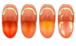Ce que la langue révèle vraiment sur votre santé 👅