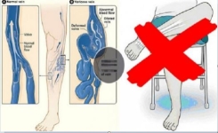 Pourquoi Vous Devriez Arrêter de Croiser les Jambes : 5 Raisons qui Vont Vous Convaincre