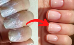 Les Merveilles du Bicarbonate de Soude : Astuces Beauté pour les Ongles et Bienfaits pour la Santé