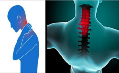 En l’espace de 90 secondes, débarrasse-vous d’une raideur du cou …Vous regretterez de ne pas l’avoir su avant !