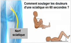  Comment soulager les douleurs d'une sciatique en 60 secondes ?