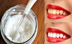 Cet astuce permet de blanchir les dents à la maison