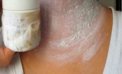 Astuces naturelles pour une peau éclatante